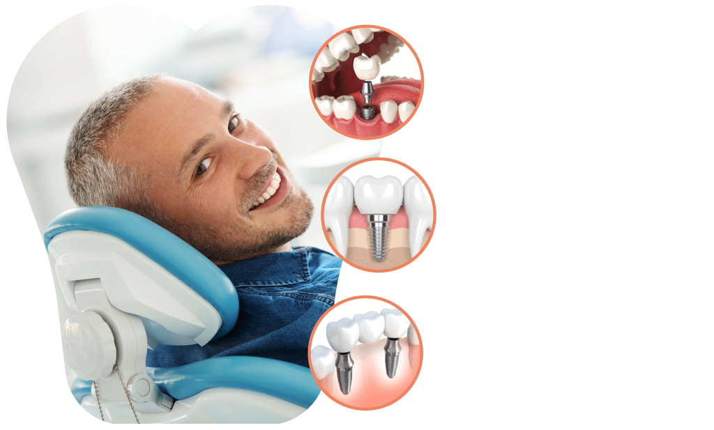 Man sitting in dentist's chair, smiling to reveal beautiful teeth, overlayed with illustrations of the dental implant process.